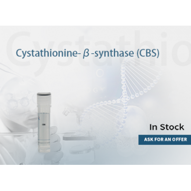 Cystathionine β-synthase